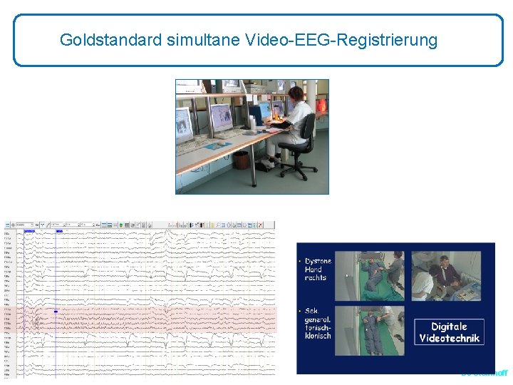 Goldstandard simultane Video-EEG-Registrierung BJ Steinhoff 