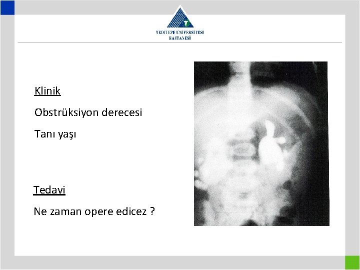 Klinik Obstrüksiyon derecesi Tanı yaşı Tedavi Ne zaman opere edicez ? 