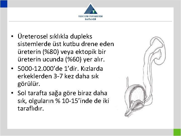  • Üreterosel sıklıkla dupleks sistemlerde üst kutbu drene eden üreterin (%80) veya ektopik