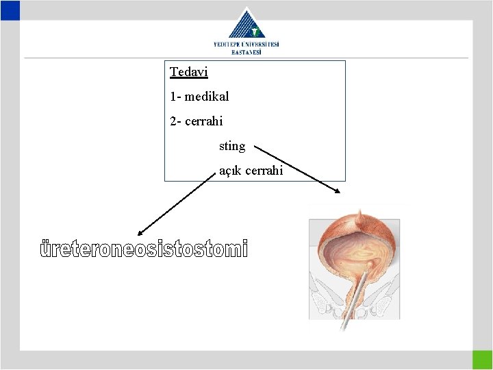 Tedavi 1 - medikal 2 - cerrahi sting açık cerrahi 