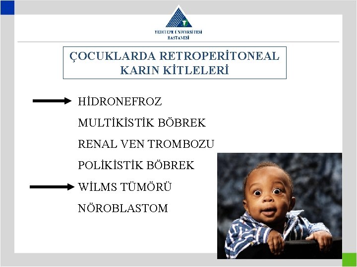 ÇOCUKLARDA RETROPERİTONEAL KARIN KİTLELERİ HİDRONEFROZ MULTİKİSTİK BÖBREK RENAL VEN TROMBOZU POLİKİSTİK BÖBREK WİLMS TÜMÖRÜ