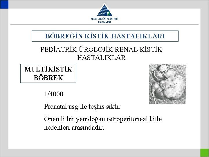 BÖBREĞİN KİSTİK HASTALIKLARI PEDİATRİK ÜROLOJİK RENAL KİSTİK HASTALIKLAR MULTİKİSTİK BÖBREK 1/4000 Prenatal usg ile