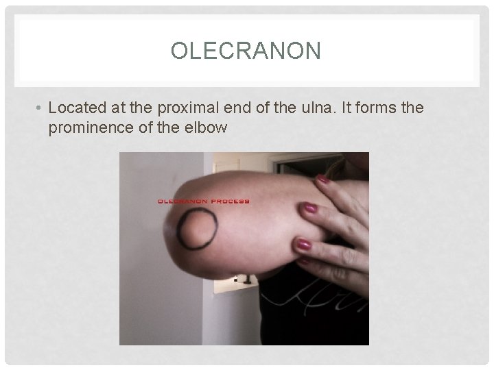 OLECRANON • Located at the proximal end of the ulna. It forms the prominence