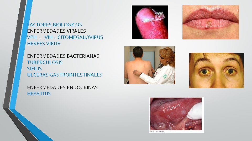 FACTORES BIOLOGICOS ENFERMEDADES VIRALES VPH - VIH - CITOMEGALOVIRUS HERPES VIRUS ENFERMEDADES BACTERIANAS TUBERCULOSIS