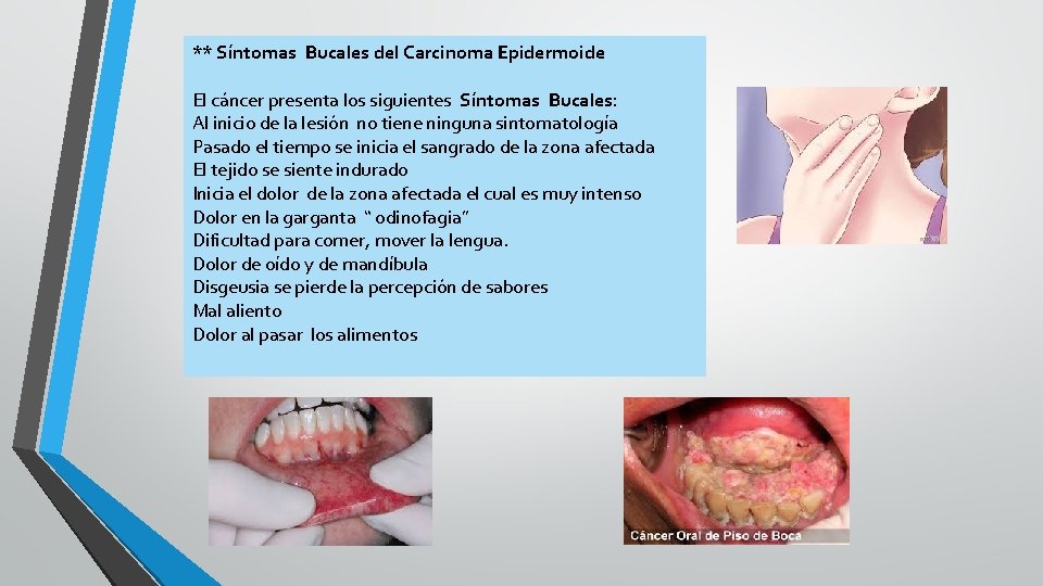 ** Síntomas Bucales del Carcinoma Epidermoide El cáncer presenta los siguientes Síntomas Bucales: Al