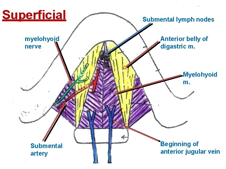 Superficial myelohyoid nerve Submental lymph nodes Anterior belly of digastric m. Myelohyoid m. Submental