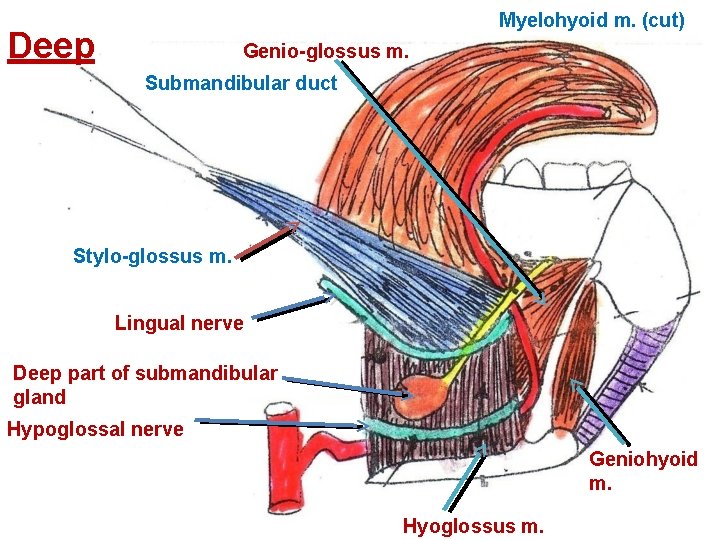 Myelohyoid m. (cut) Deep Genio-glossus m. Submandibular duct Stylo-glossus m. Lingual nerve Deep part