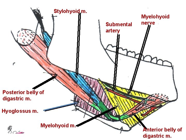 Stylohyoid m. Submental artery Myelohyoid nerve Posterior belly of digastric m. Hyoglossus m. Myelohyoid