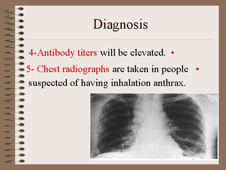 Diagnosis 4 -Antibody titers will be elevated. • 5 - Chest radiographs are taken