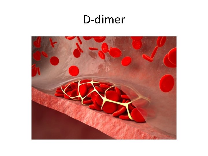 D-dimer 