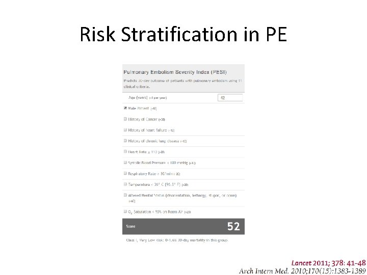 Risk Stratification in PE 