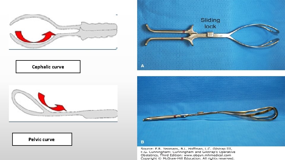 Cephalic curve Pelvic curve 5 
