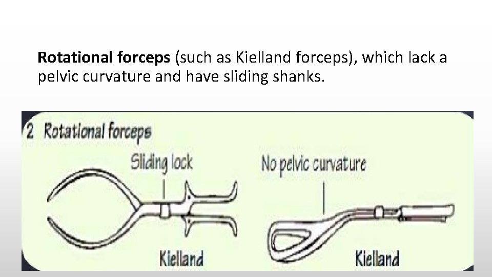 Rotational forceps (such as Kielland forceps), which lack a pelvic curvature and have sliding