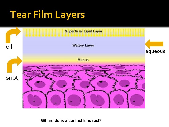 Tear Film Layers oil aqueous snot Where does a contact lens rest? 