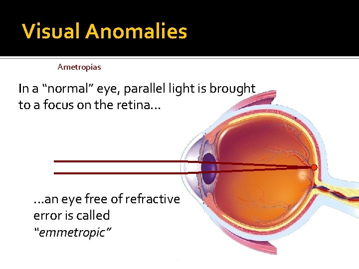 Visual Anomalies Ametropias In a “normal” eye, parallel light is brought to a focus