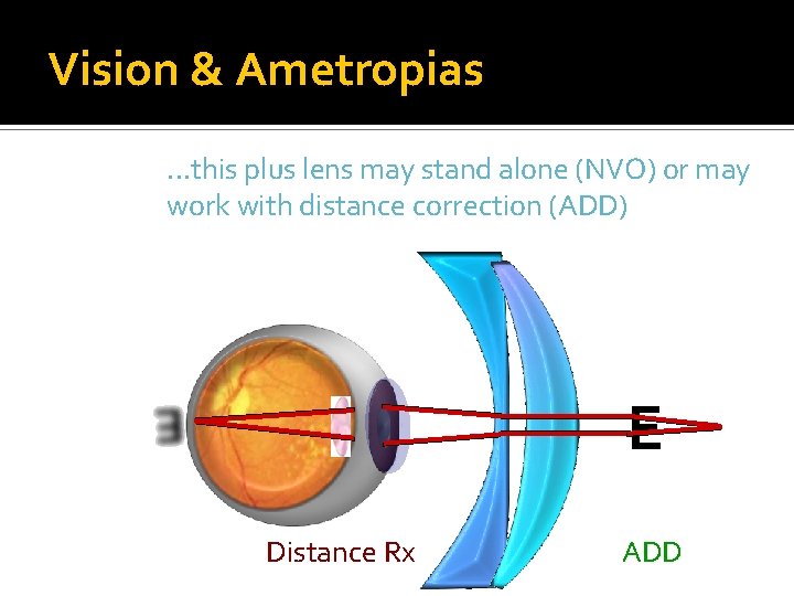 Vision & Ametropias. . . this plus lens may stand alone (NVO) or may