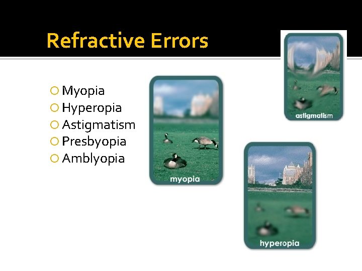 Refractive Errors Myopia Hyperopia Astigmatism Presbyopia Amblyopia 