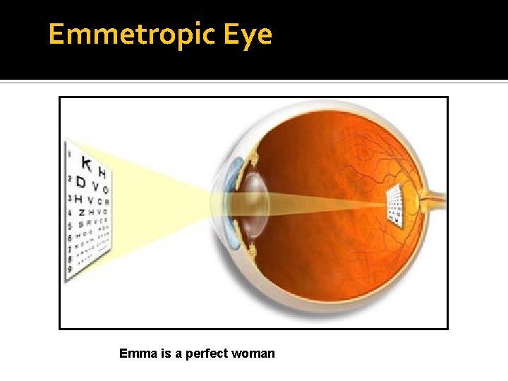 Emmetropic Eye Emma is a perfect woman 