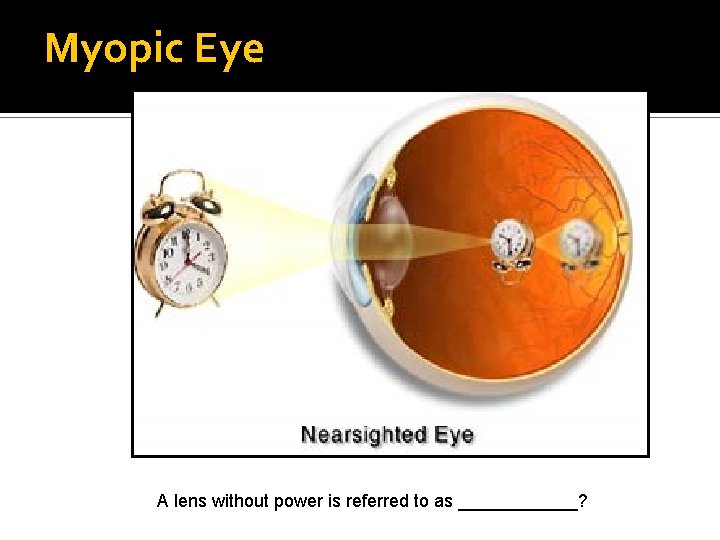 Myopic Eye A lens without power is referred to as ______? 