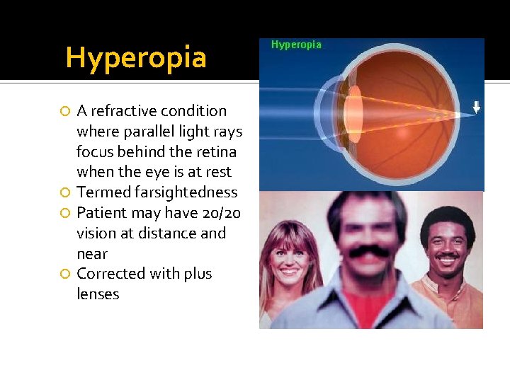 Hyperopia A refractive condition where parallel light rays focus behind the retina when the