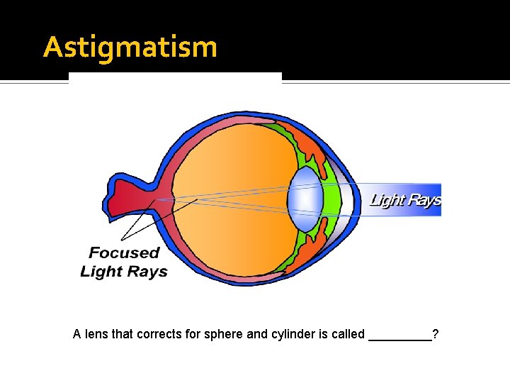 Astigmatism A lens that corrects for sphere and cylinder is called _____? 