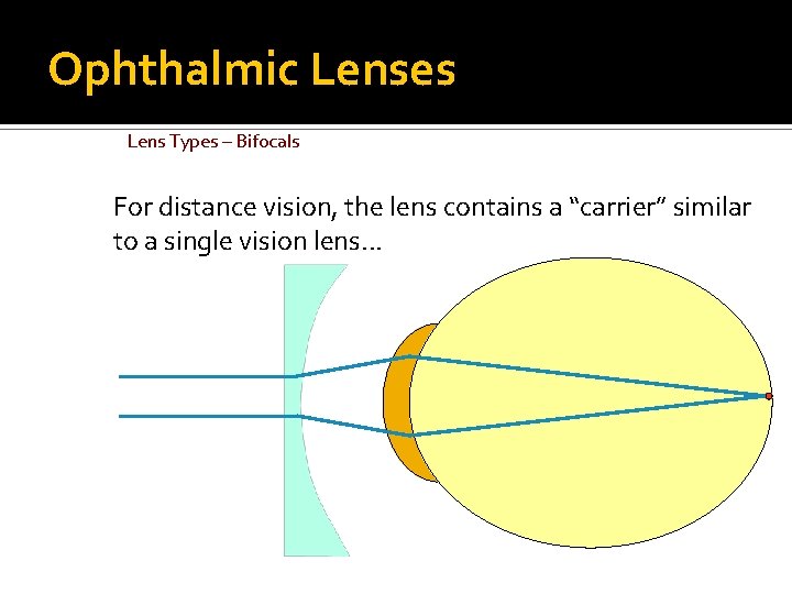 Ophthalmic Lenses Lens Types – Bifocals For distance vision, the lens contains a “carrier”