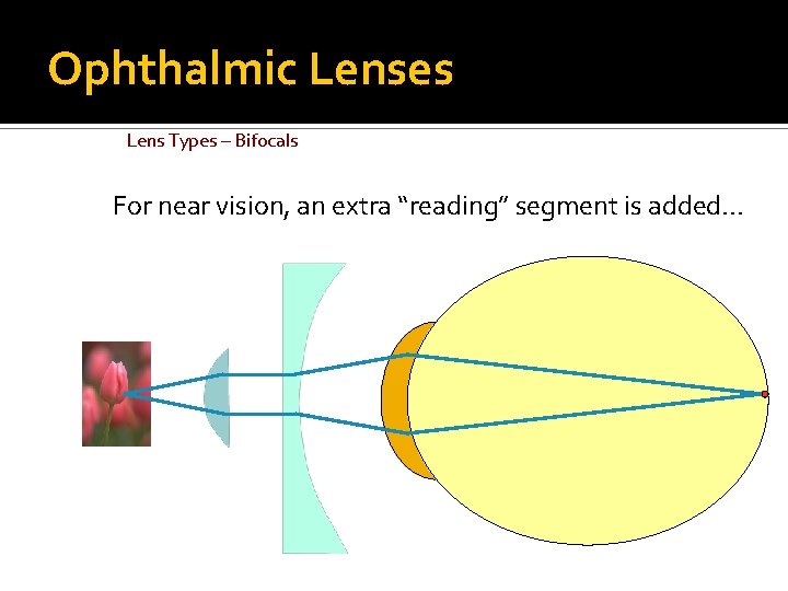 Ophthalmic Lenses Lens Types – Bifocals For near vision, an extra “reading” segment is