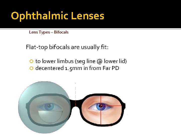 Ophthalmic Lenses Lens Types – Bifocals Flat-top bifocals are usually fit: to lower limbus