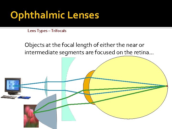 Ophthalmic Lenses Lens Types – Trifocals Objects at the focal length of either the