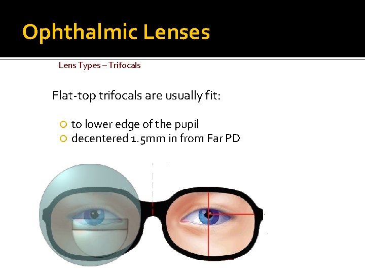 Ophthalmic Lenses Lens Types – Trifocals Flat-top trifocals are usually fit: to lower edge