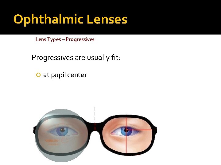 Ophthalmic Lenses Lens Types – Progressives are usually fit: at pupil center 