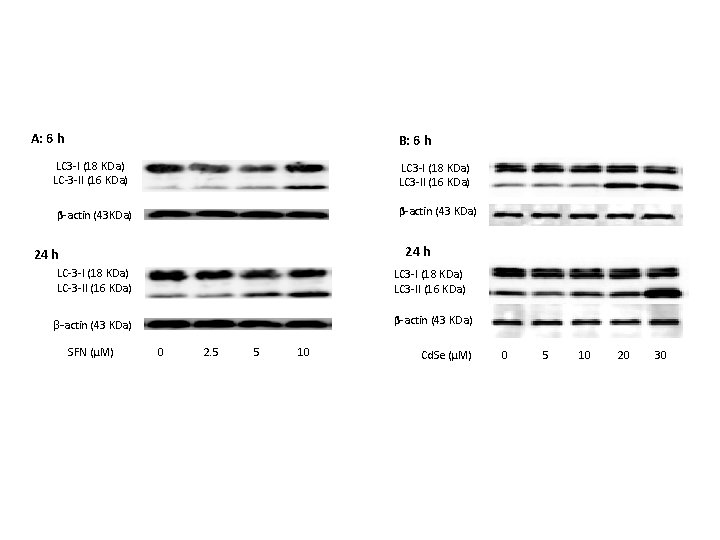 A: 6 h B: 6 h LC 3 -I (18 KDa) LC-3 -II (16