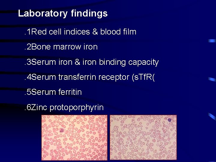 Laboratory findings. 1 Red cell indices & blood film. 2 Bone marrow iron. 3