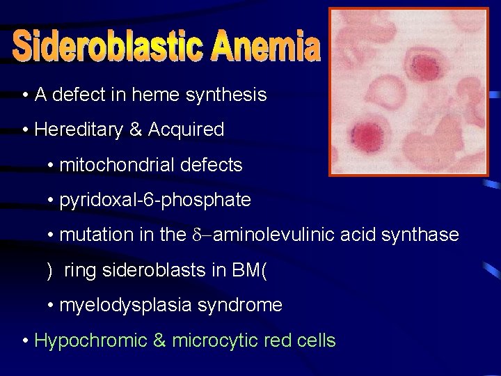  • A defect in heme synthesis • Hereditary & Acquired • mitochondrial defects