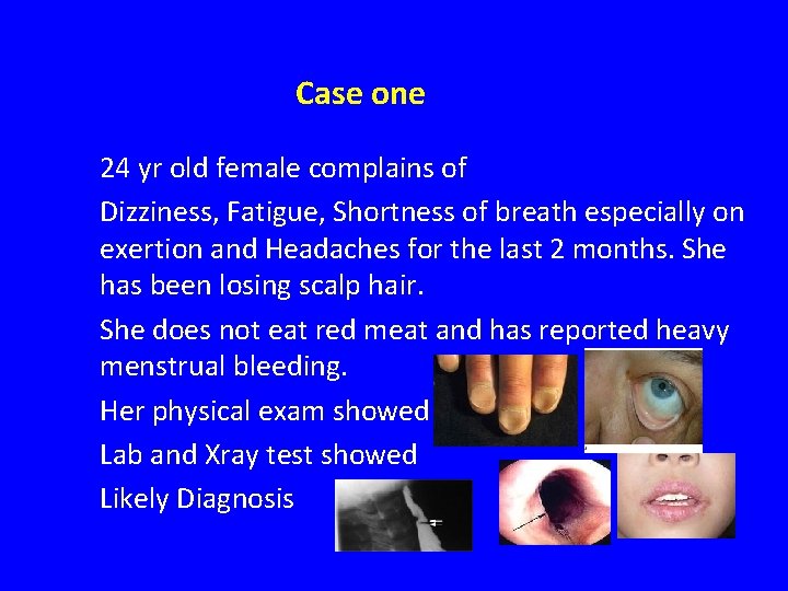 Case one 24 yr old female complains of Dizziness, Fatigue, Shortness of breath especially