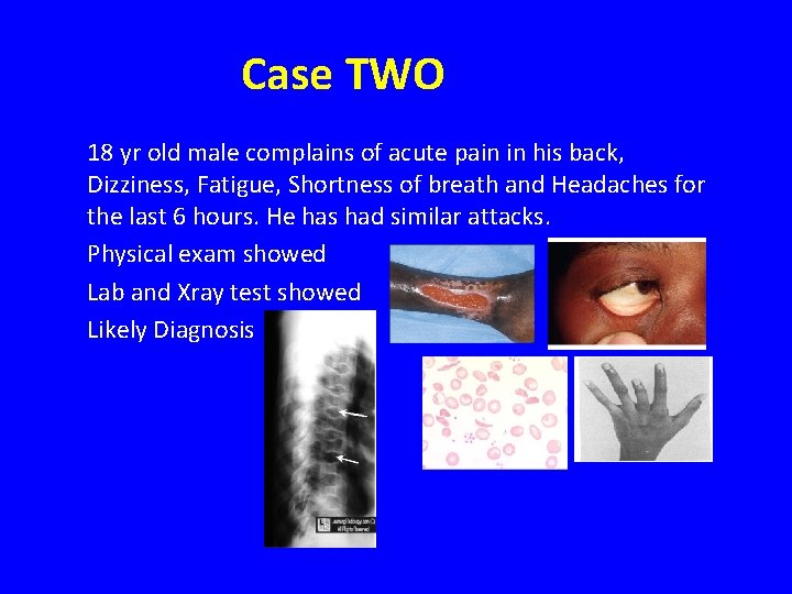 Case TWO 18 yr old male complains of acute pain in his back, Dizziness,