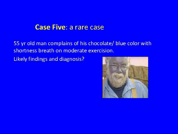 Case Five: a rare case 55 yr old man complains of his chocolate/ blue