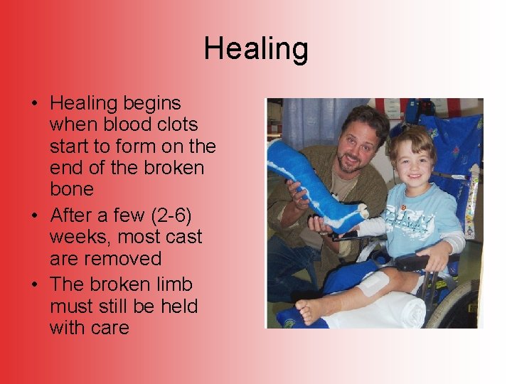 Healing • Healing begins when blood clots start to form on the end of
