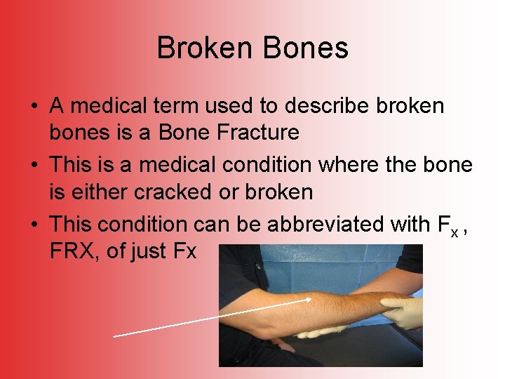 Broken Bones • A medical term used to describe broken bones is a Bone