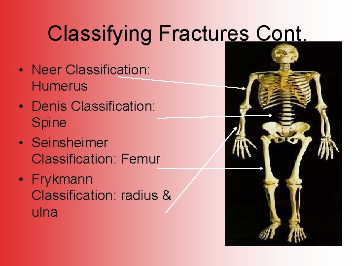 Classifying Fractures Cont. • Neer Classification: Humerus • Denis Classification: Spine • Seinsheimer Classification: