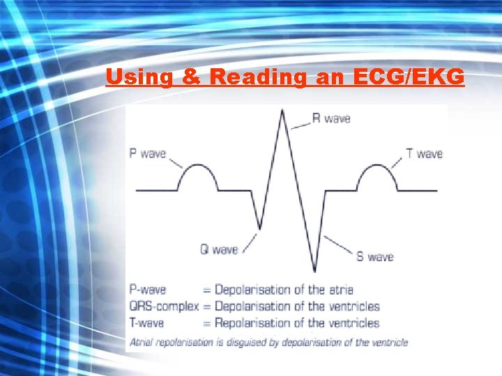 Using & Reading an ECG/EKG 
