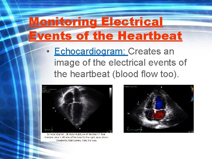 Monitoring Electrical Events of the Heartbeat • Echocardiogram: Creates an image of the electrical