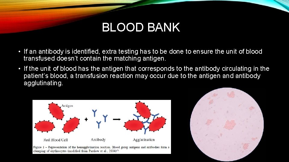 BLOOD BANK • If an antibody is identified, extra testing has to be done