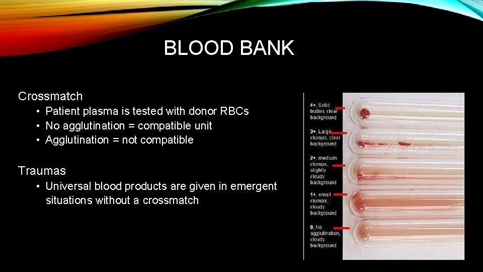 BLOOD BANK Crossmatch • Patient plasma is tested with donor RBCs • No agglutination