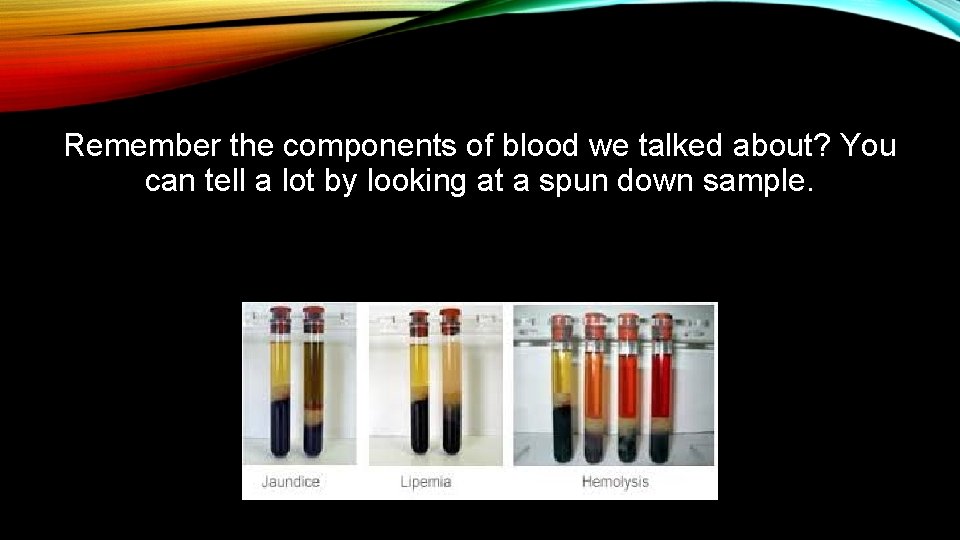 Remember the components of blood we talked about? You can tell a lot by
