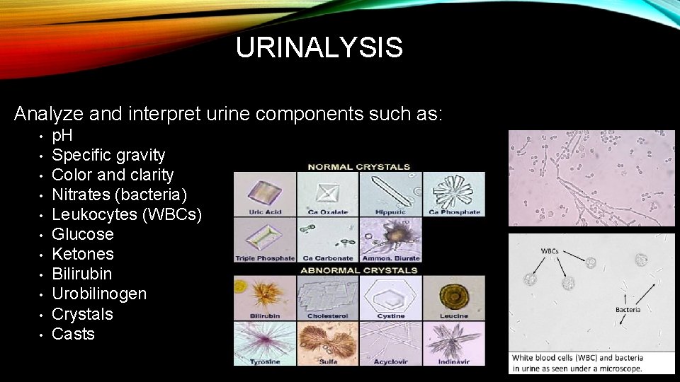 URINALYSIS Analyze and interpret urine components such as: • • • p. H Specific