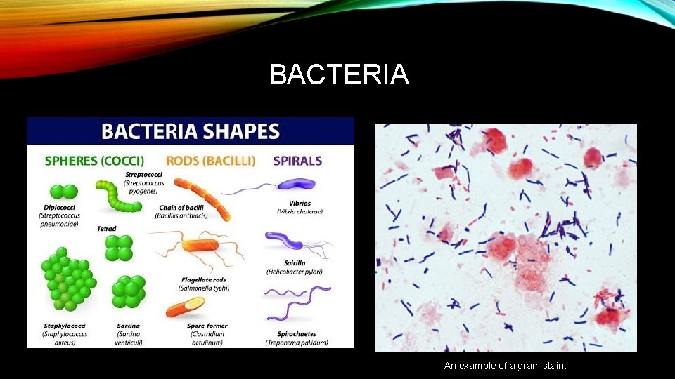 BACTERIA An example of a gram stain. 