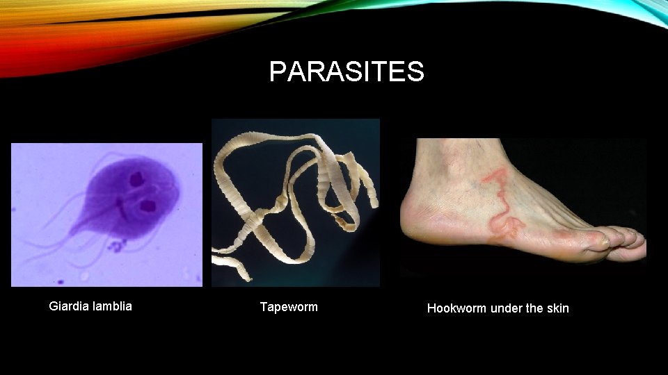 PARASITES Giardia lamblia Tapeworm Hookworm under the skin 
