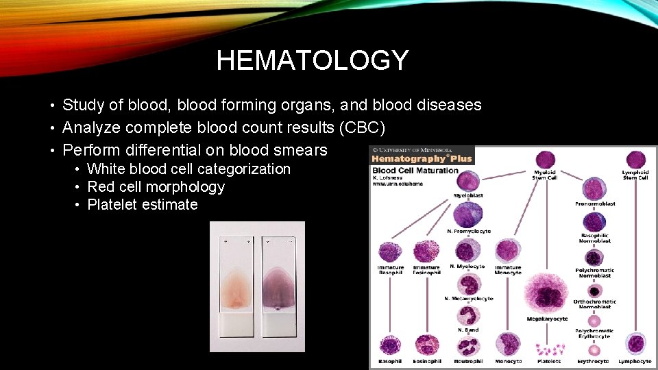 HEMATOLOGY • Study of blood, blood forming organs, and blood diseases • Analyze complete