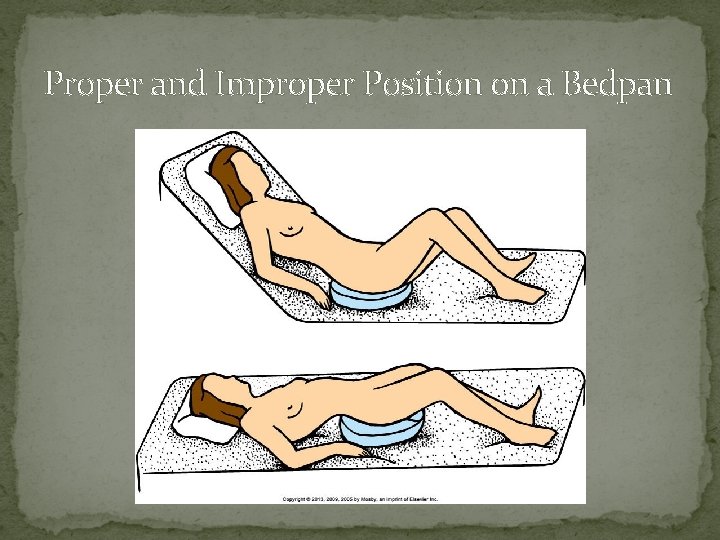 Proper and Improper Position on a Bedpan 